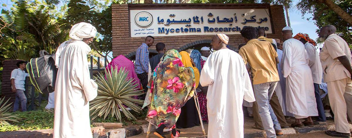 The War Destroys Sudan’s Mycetoma Research Center: A Health Catastrophe Threatening the Lives of the Poor
