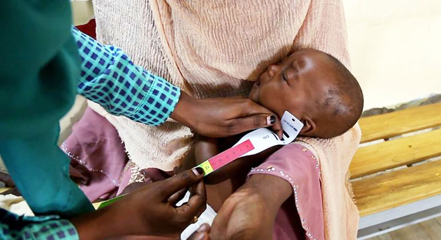 825 ألف طفل سوداني مهددون بسوء التغذية